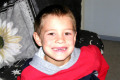 029-missing-front-teeth-31May03